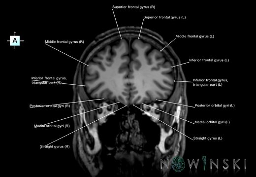 G6.T3.1.V1.P30.Cerebrum–Triplanar