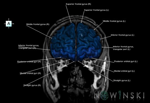 G6.T3.1.V1.P30S.Cerebrum–Triplanar