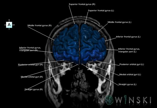 G6.T3.1.V1.P30S.Cerebrum–Triplanar