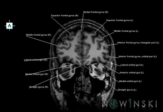 G6.T3.1.V1.P40.Cerebrum–Triplanar