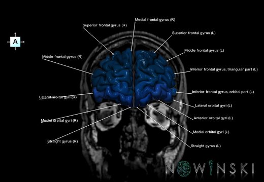 G6.T3.1.V1.P40S.Cerebrum–Triplanar