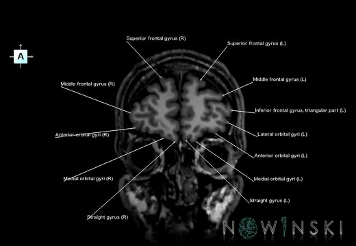 G6.T3.1.V1.P50.Cerebrum–Triplanar