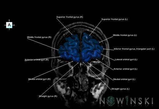 G6.T3.1.V1.P50S.Cerebrum–Triplanar