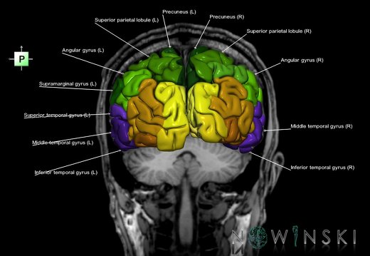 G6.T3.1.V3.P-50S.Cerebrum–Triplanar