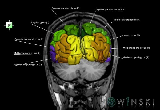 G6.T3.1.V3.P-60S.Cerebrum–Triplanar