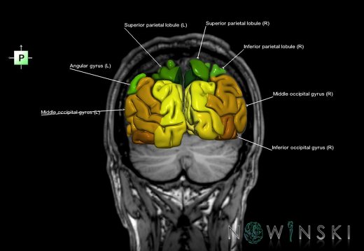 G6.T3.1.V3.P-70S.Cerebrum–Triplanar