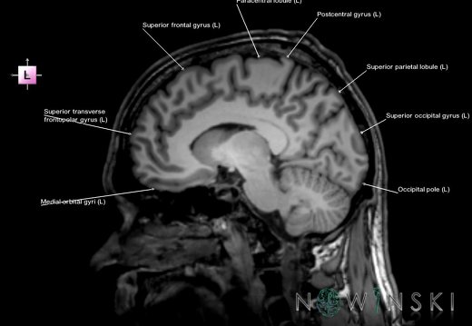 G6.T3.1.V2.P10.Cerebrum–Triplanar