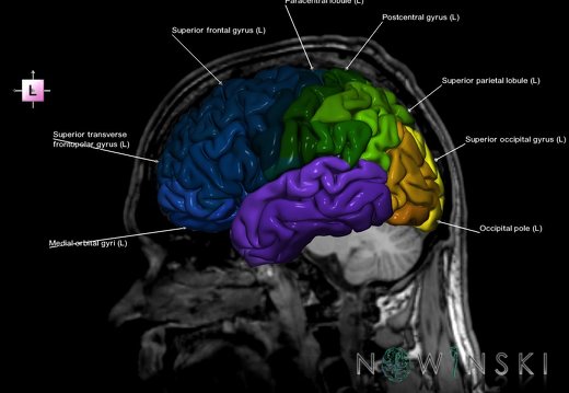 G6.T3.1.V2.P10S.Cerebrum–Triplanar