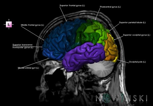 G6.T3.1.V2.P20S.Cerebrum–Triplanar