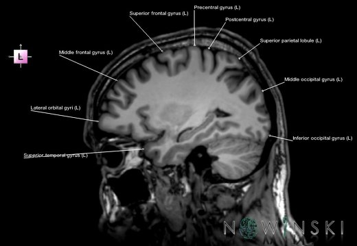 G6.T3.1.V2.P30.Cerebrum–Triplanar