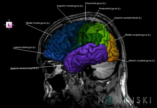 G6.T3.1.V2.P30S.Cerebrum–Triplanar