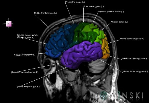 G6.T3.1.V2.P40S.Cerebrum–Triplanar