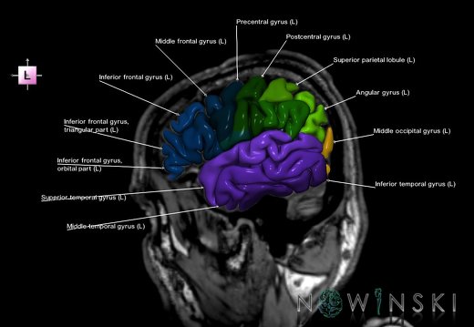 G6.T3.1.V2.P50S.Cerebrum–Triplanar