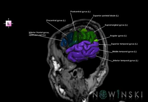 G6.T3.1.V2.P60S.Cerebrum–Triplanar