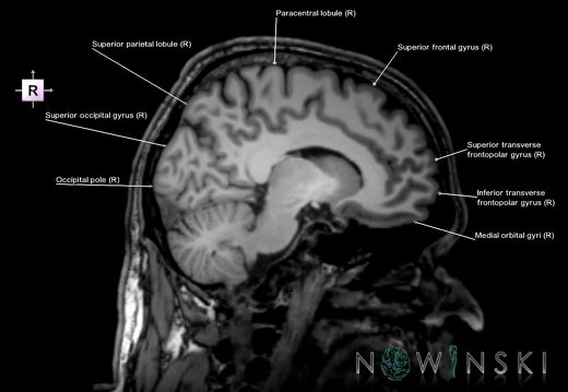 G6.T3.1.V4.P-10.Cerebrum–Triplanar