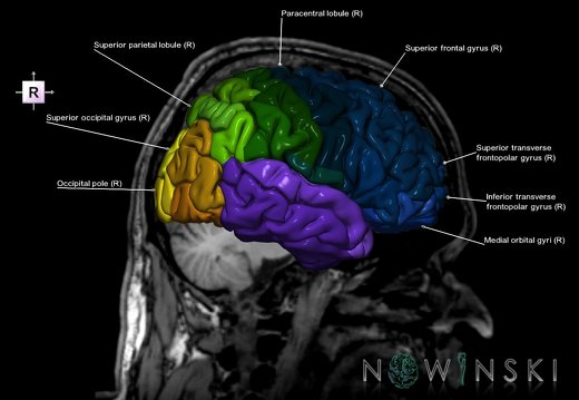 G6.T3.1.V4.P-10S.Cerebrum–Triplanar