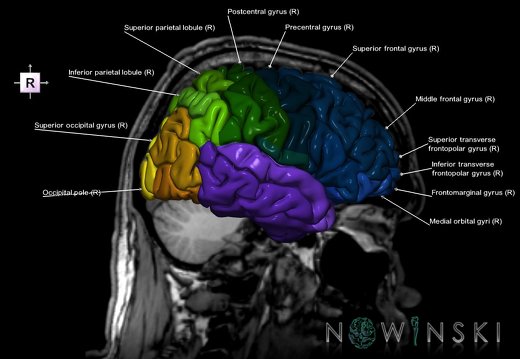 G6.T3.1.V4.P-20S.Cerebrum–Triplanar