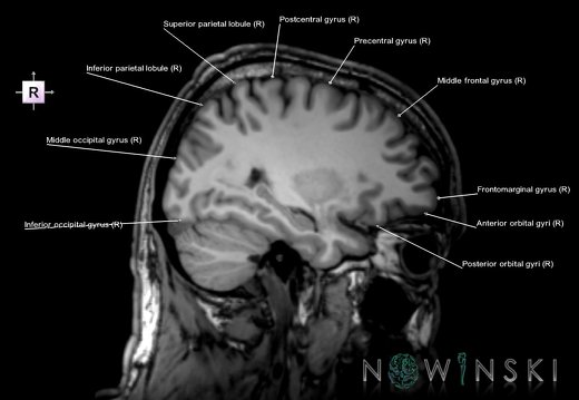 G6.T3.1.V4.P-30.Cerebrum–Triplanar