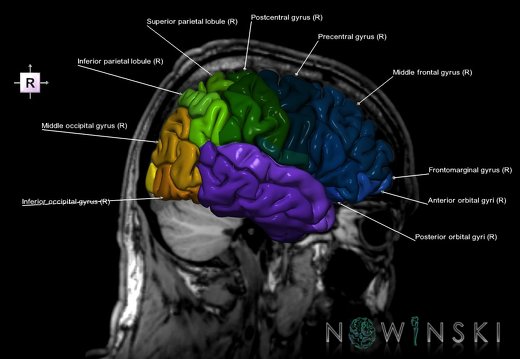 G6.T3.1.V4.P-30S.Cerebrum–Triplanar