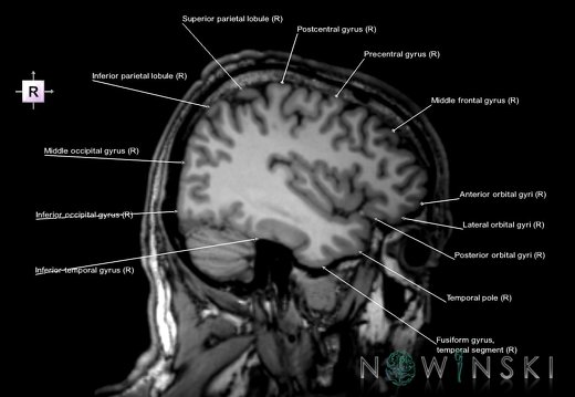 G6.T3.1.V4.P-40.Cerebrum–Triplanar