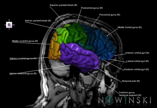 G6.T3.1.V4.P-40S.Cerebrum–Triplanar