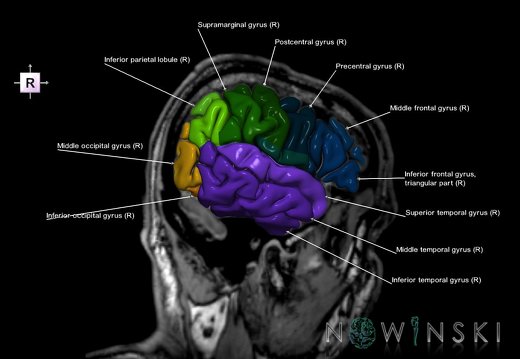 G6.T3.1.V4.P-50S.Cerebrum–Triplanar