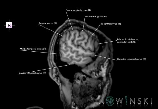 G6.T3.1.V4.P-60.Cerebrum–Triplanar