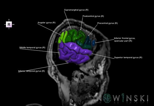 G6.T3.1.V4.P-60S.Cerebrum–Triplanar