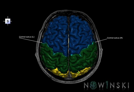 G6.T7.3.V5.P20S.Central sulcus–Triplanar