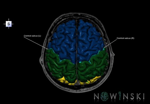 G6.T7.3.V5.P30S.Central sulcus–Triplanar