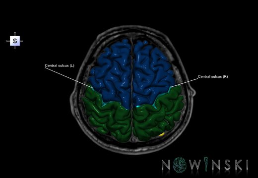 G6T7.3.CentralSulcus–Triplanar