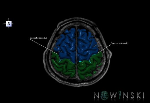 G6.T7.3.V5.P50S.Central sulcus–Triplanar