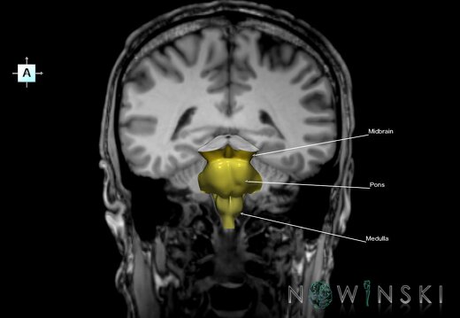 G6.T9.4.V1.P-40S.Brainstem–Triplanar