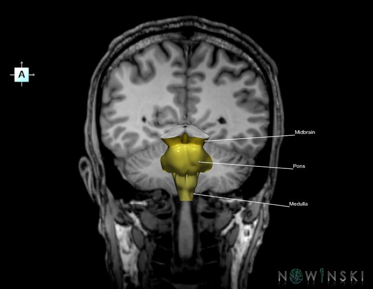 G6.T9.4.V1.P-50S.Brainstem–Triplanar.tiff