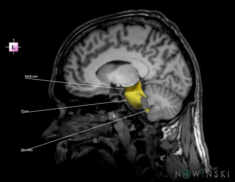 G6.T9.4.V2.P10S.Brainstem–Triplanar.tiff