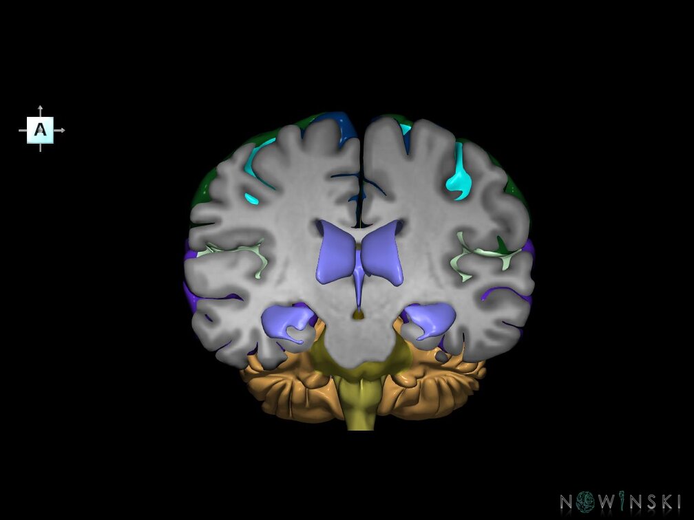 G7.T2.1-12.V1.Da-20.C2.L0.Brain anterior cut–Cerebral ventricles
