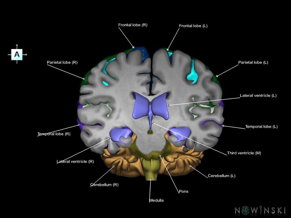 G7.T2.1-12.V1.Da-20.C2.L1.Brain anterior cut–Cerebral ventricles