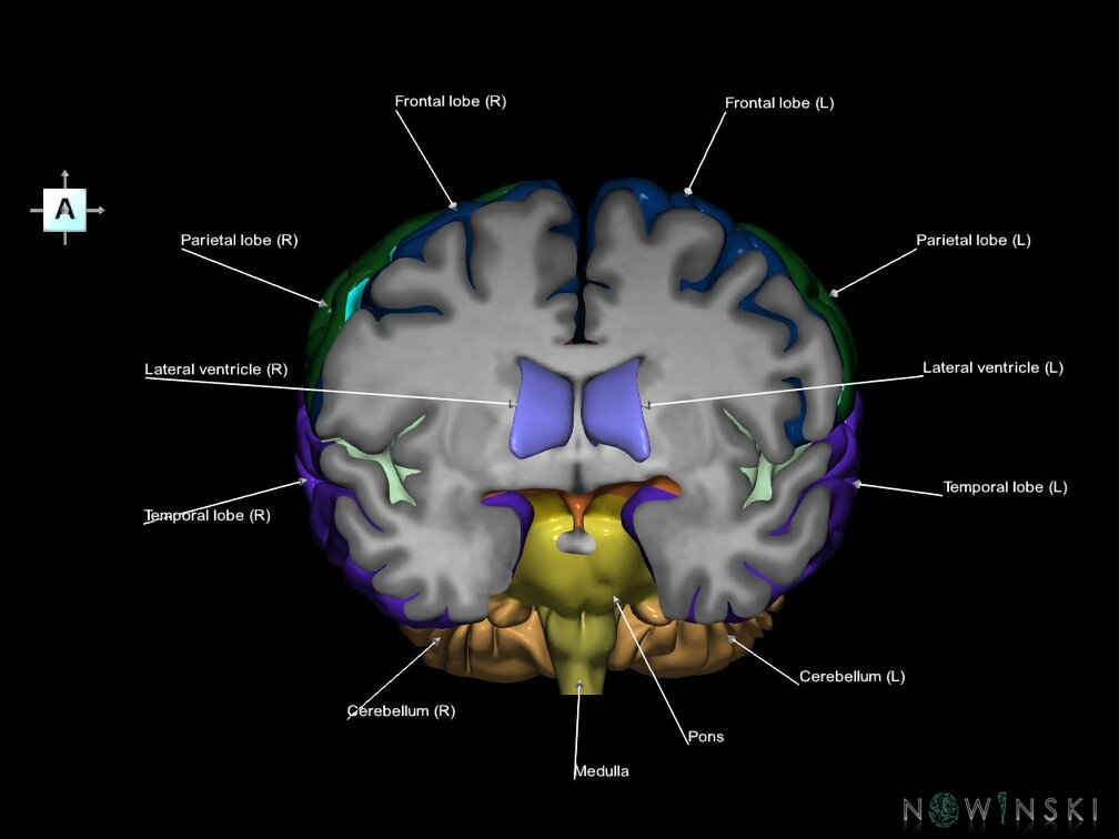 G7.T2.1-12.V1.Da00.C2.L1.Brain anterior cut–Cerebral ventricles