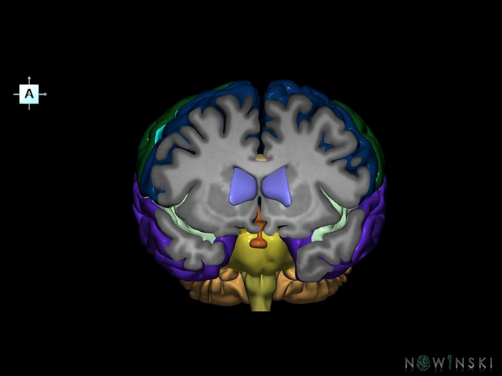 G7.T2.1-12.V1.Da10.C2.L0.Brain anterior cut–Cerebral ventricles