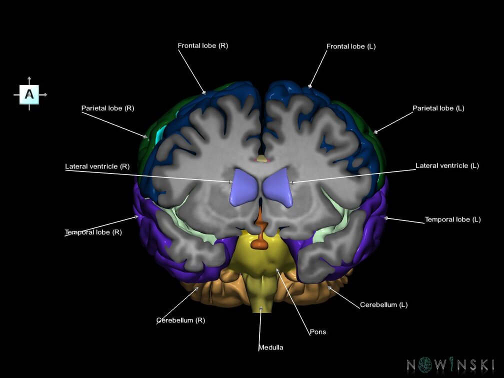 G7.T2.1-12.V1.Da10.C2.L1.Brain anterior cut–Cerebral ventricles