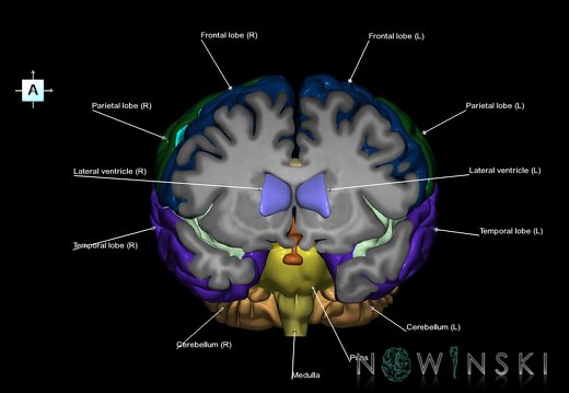 G7.T2.1-12.V1.Da10.C2.L1.Brain anterior cut–Cerebral ventricles