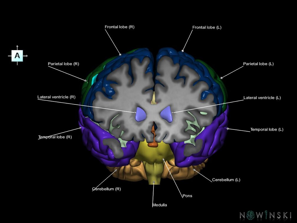 G7.T2.1-12.V1.Da20.C2.L1.Brain anterior cut–Cerebral ventricles