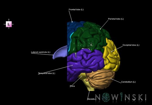 G7.T2.1-12.V2.Da00.C2.L1.Brain anterior cut–Cerebral ventricles