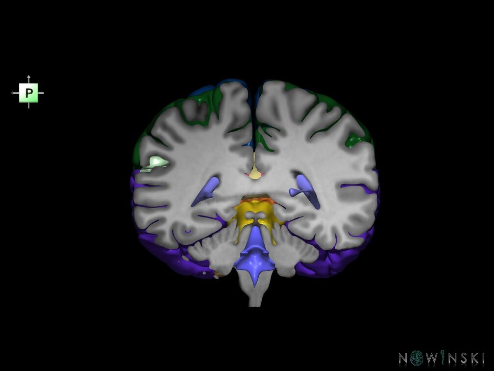 G7.T2.1-12.V3.Dp-40.C2.L0.Brain posterior cut–Cerebral ventricles