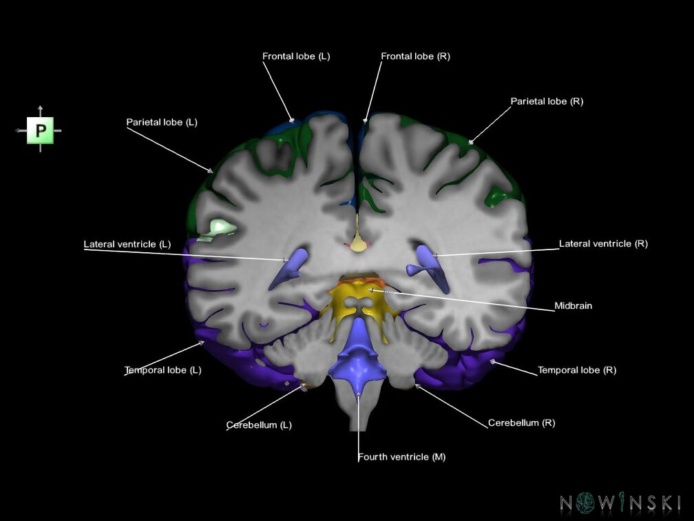 G7.T2.1-12.V3.Dp-40.C2.L1.Brain posterior cut–Cerebral ventricles