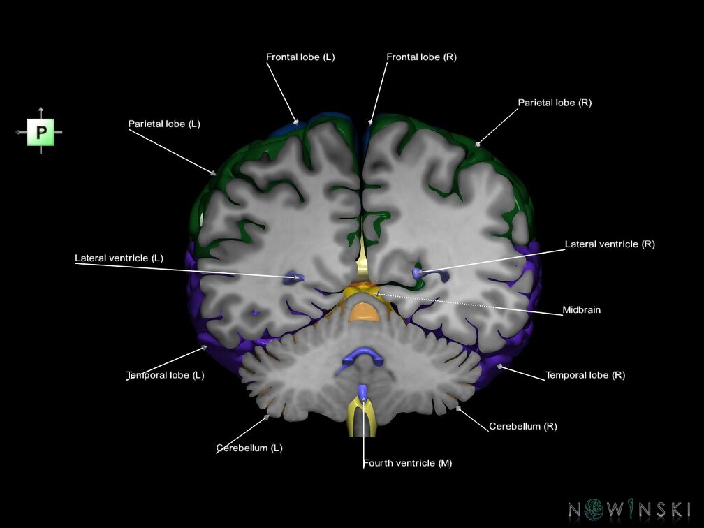 G7.T2.1-12.V3.Dp-50.C2.L1.Brain posterior cut–Cerebral ventricles