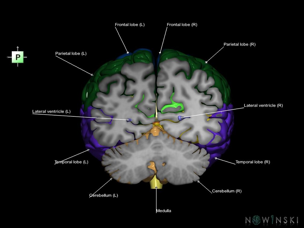 G7.T2.1-12.V3.Dp-60.C2.L1.Brain posterior cut–Cerebral ventricles