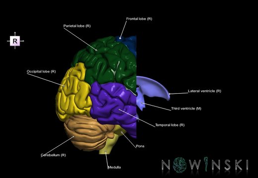 G7.T2.1-12.V4.Da-10.C2.L1.Brain anterior cut–Cerebral ventricles