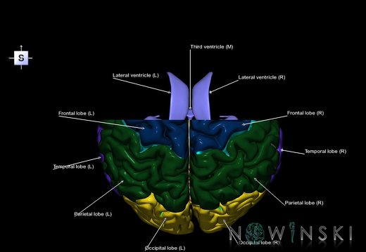 G7.T2.1-12.V5.Da-10.C2.L1.Brain anterior cut–Cerebral ventricles
