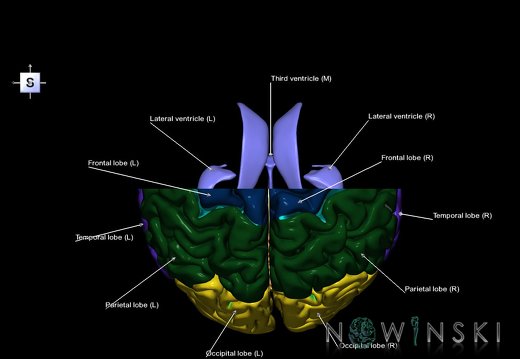 G7.T2.1-12.V5.Da-20.C2.L1.Brain anterior cut–Cerebral ventricles